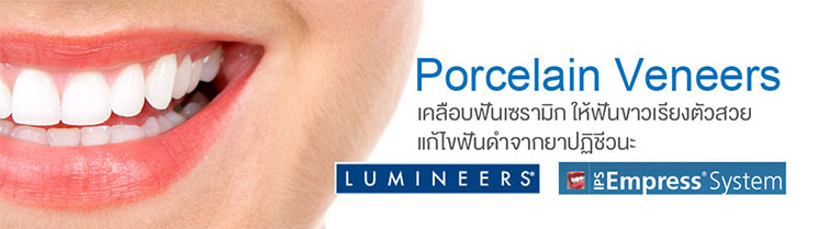 เคลือบฟัน IPS Empress Esthetics