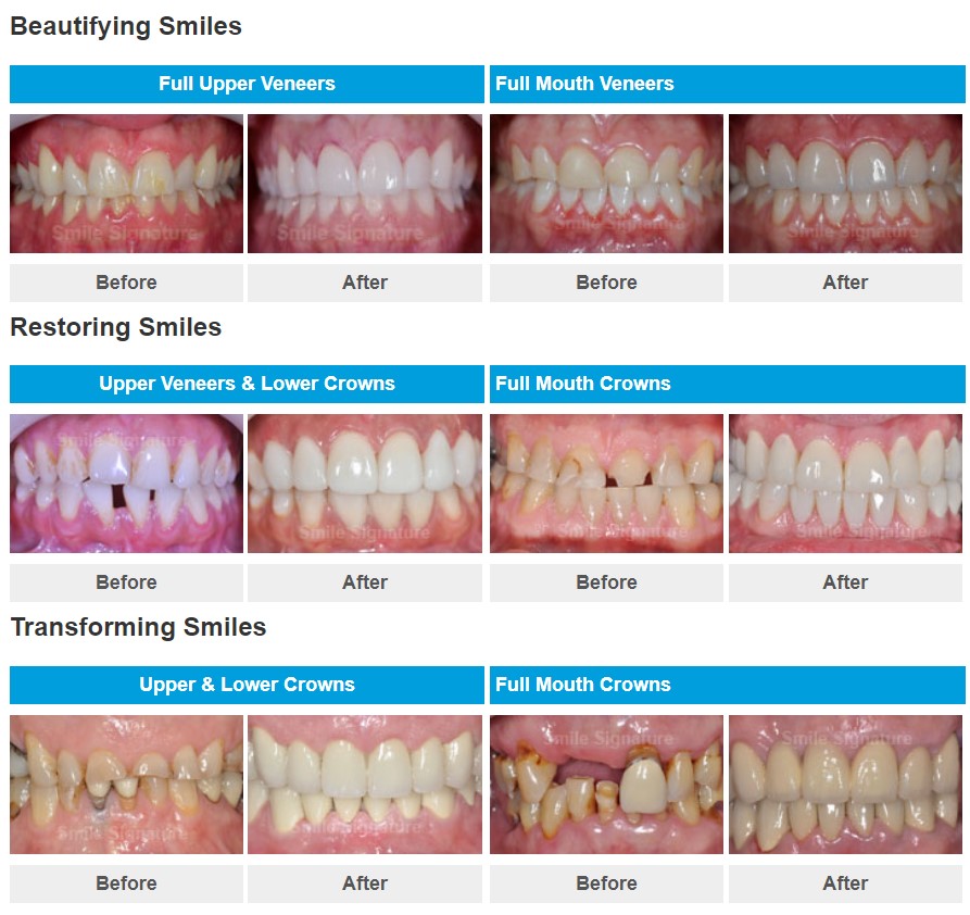 Smile Makeover Dental Center