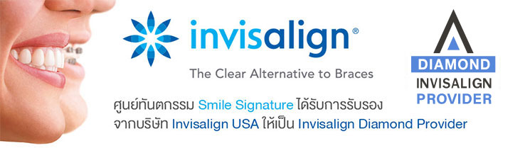 Invisalign Removable. Comfortable. Non-visible at Smile Signature