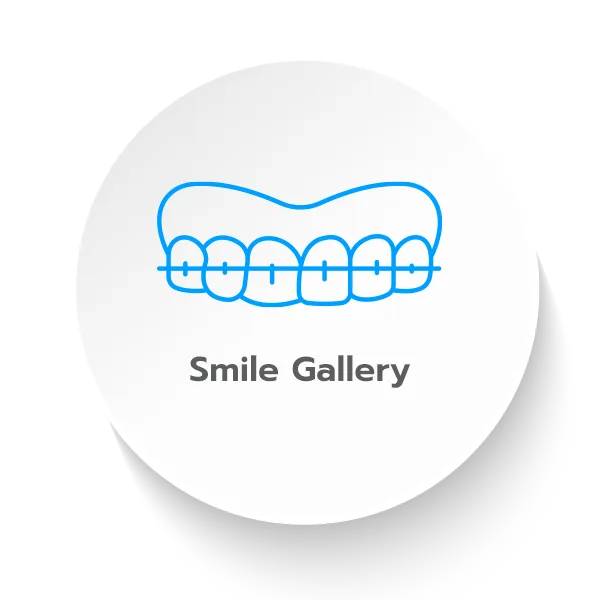 รีวิวทำฟัน Smile Gallery 