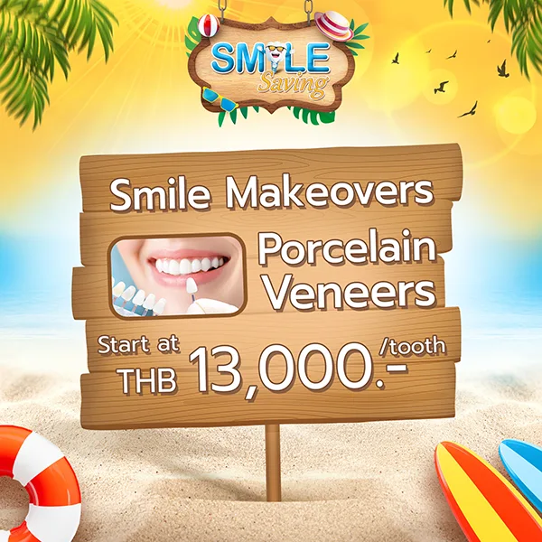 promotion dental veneer