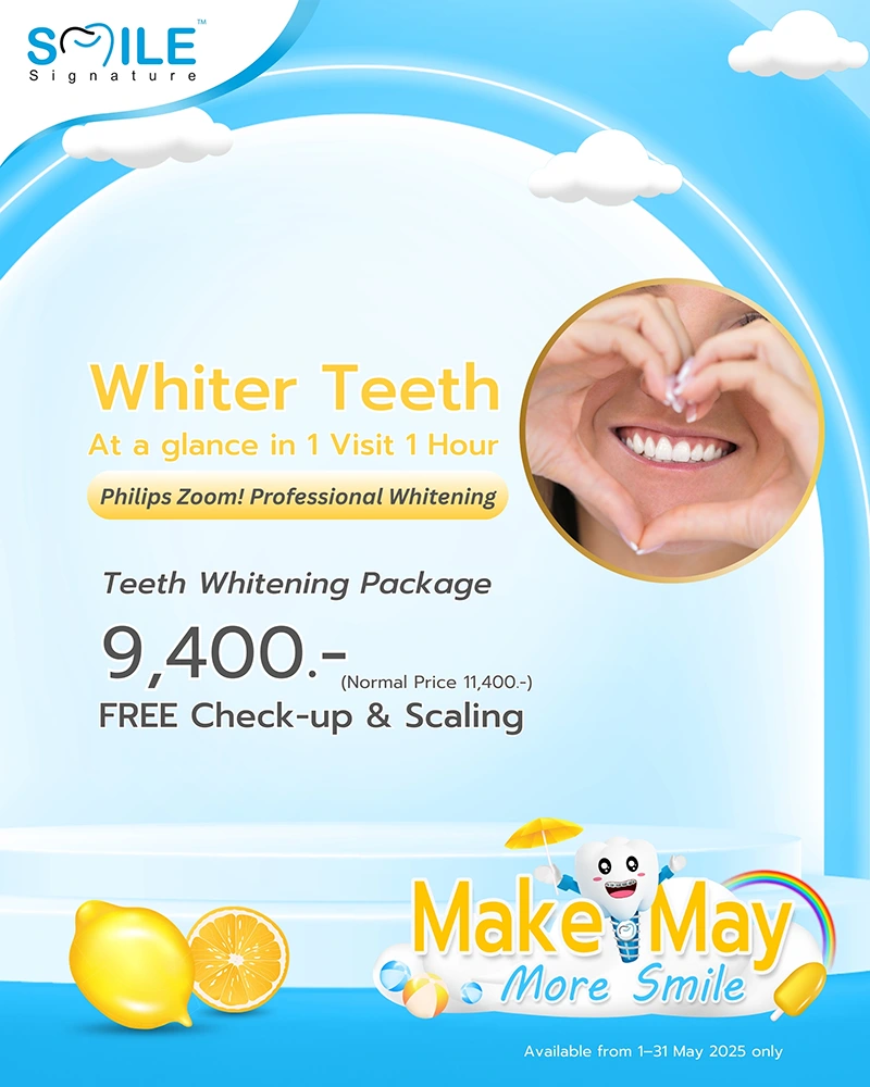 Promotion Teeth Whitening