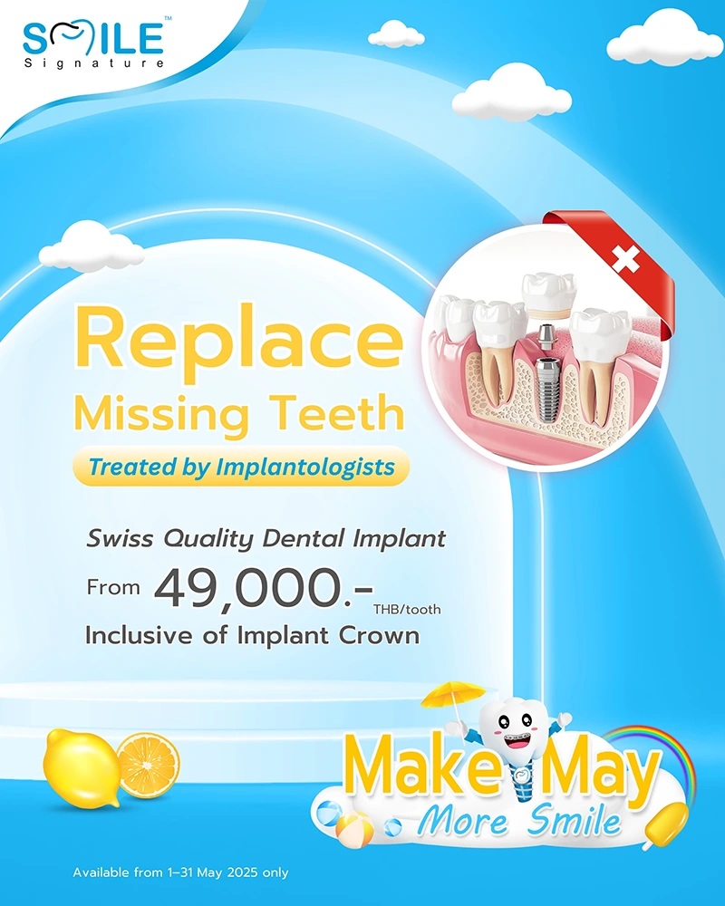 promotion dental implant