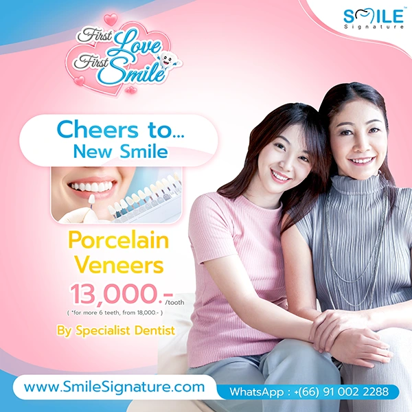 promotion dental veneer