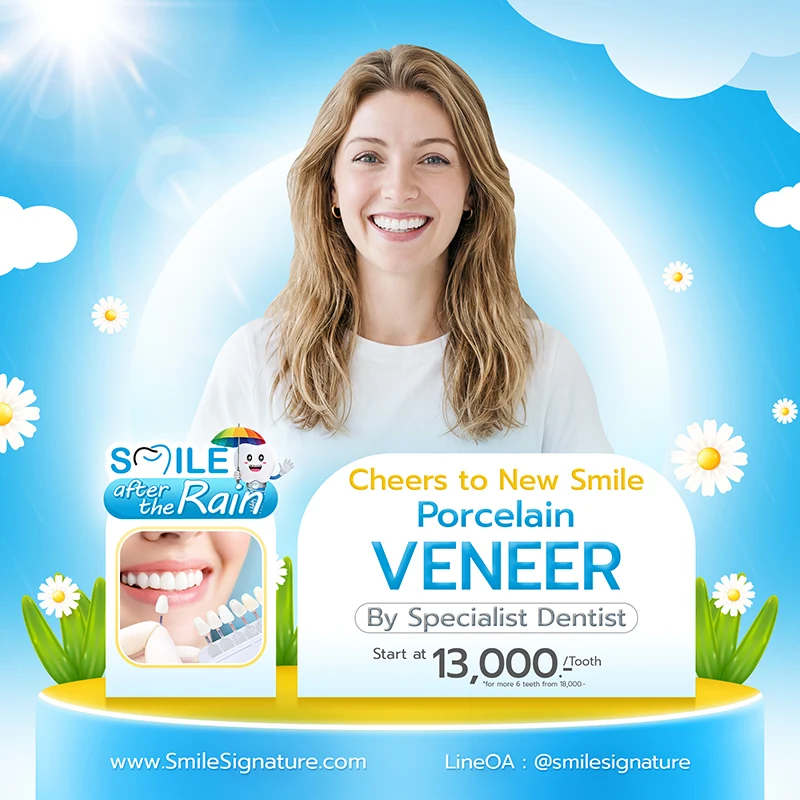 promotion dental veneer