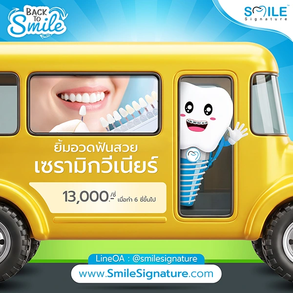promotion dental veneer