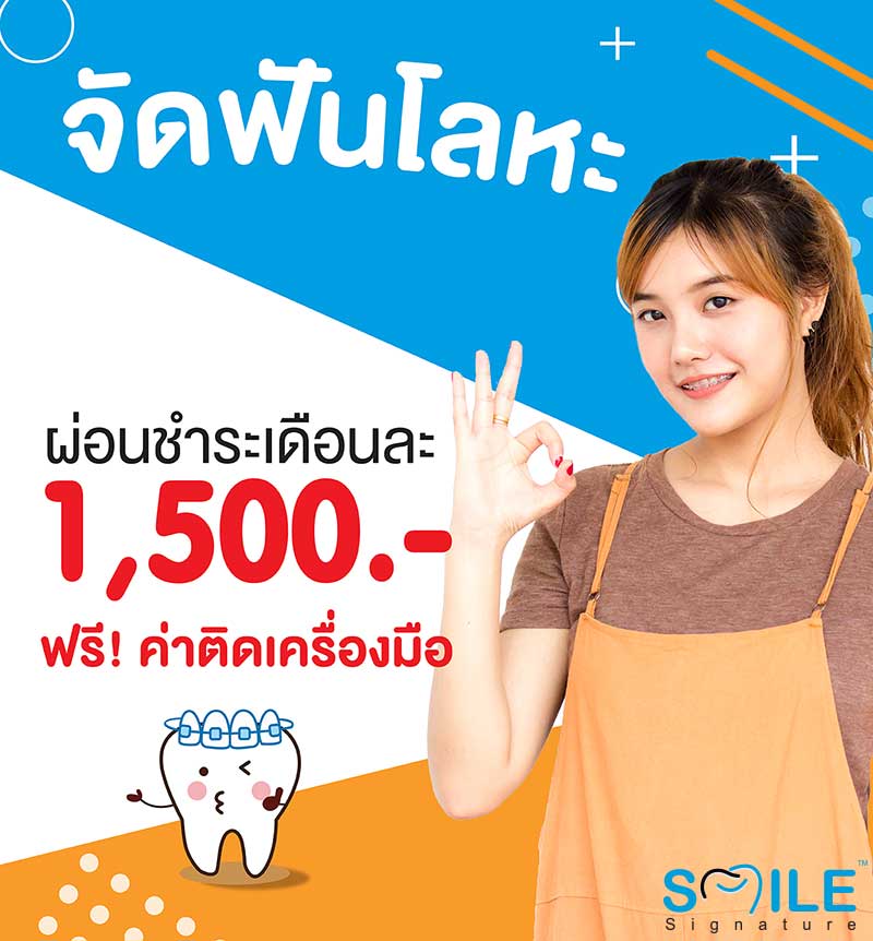 ลงทะเบียนจองโปรโมชั่นจัดฟันโลหะ