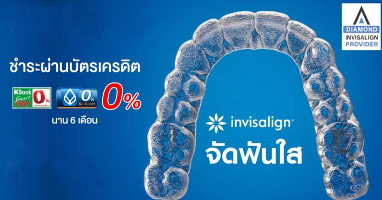 จัดฟันใส ราคา