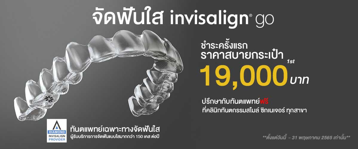 จัดฟันใส ราคา 2565