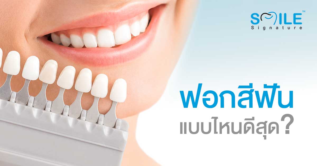 ฟอกสีฟัน