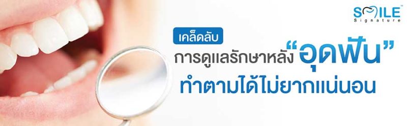 เคล็ดลับการดูแลรักษาหลังอุดฟัน