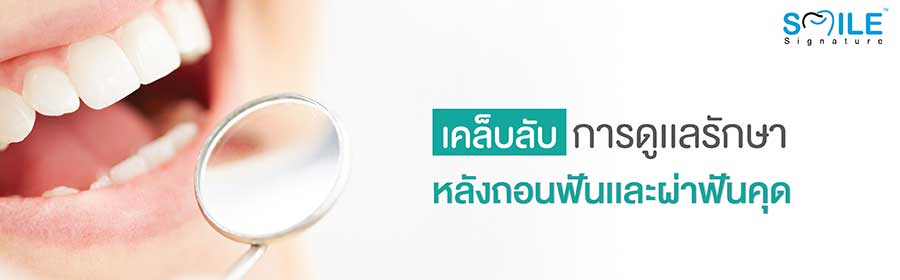 เคล็ดลับการดูแลรักษาหลังอุดฟัน