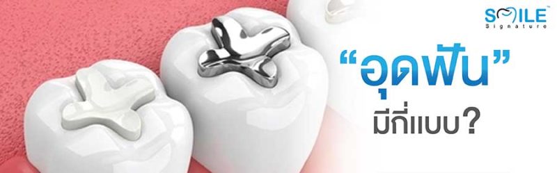 ทันตกรรมอุดฟันมีกี่แบบ