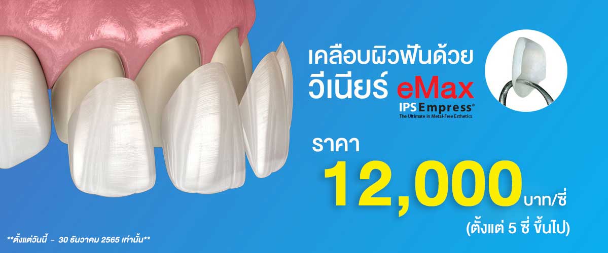 ทำวีเนียร์ฟันสวย รัชดา