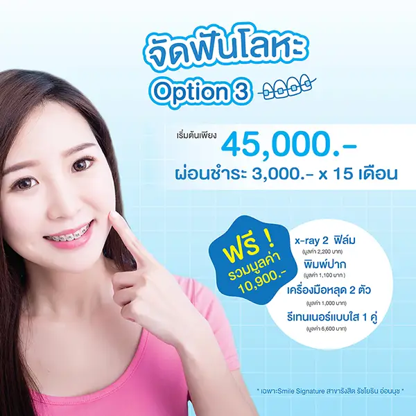 ราคาจัดฟัน 2566