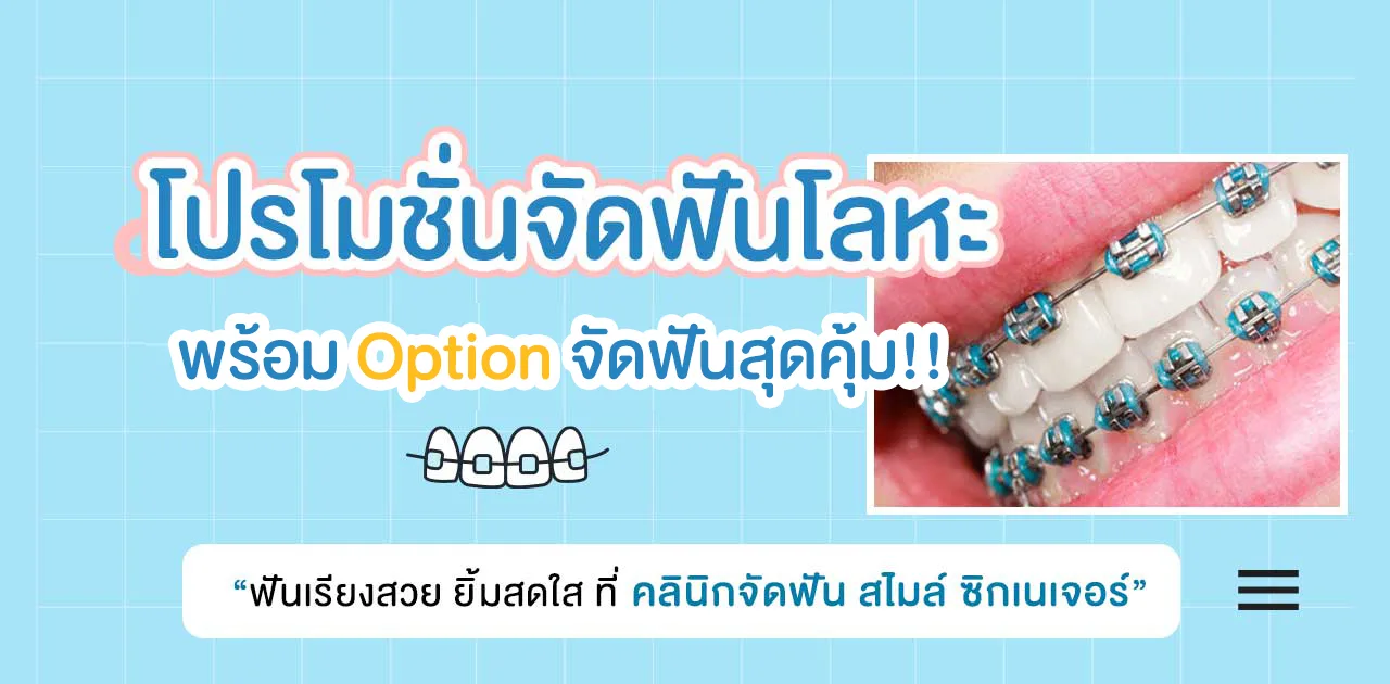 โปรโมชั่นจัดฟันโลหะ