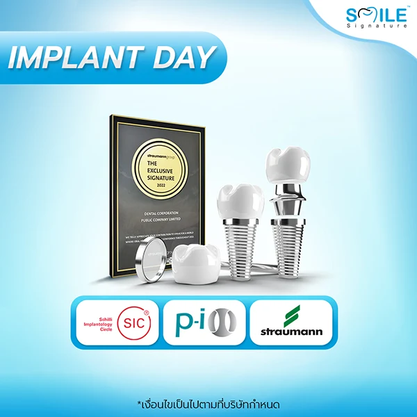 Implant Day โปรโมชั่นรากฟเทียม