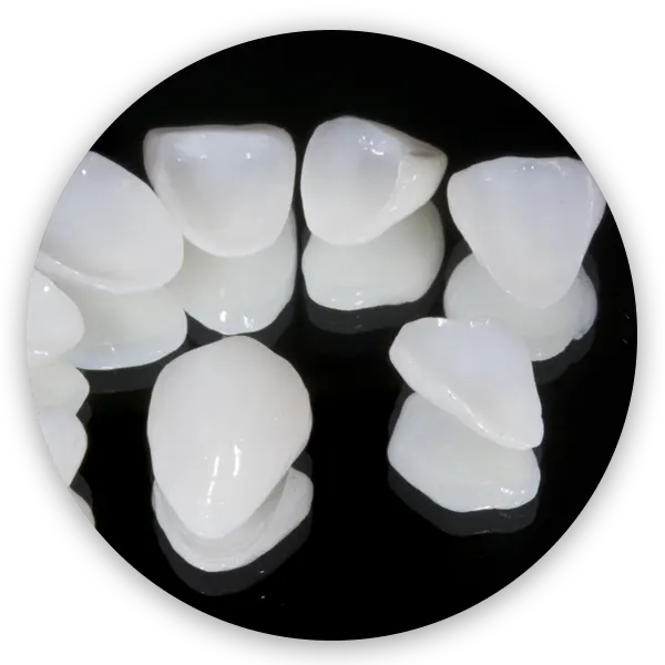 วีเนียร์ หรือการเคลือบผิวฟัน