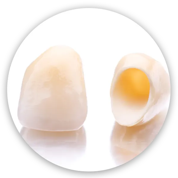 การครอบฟัน