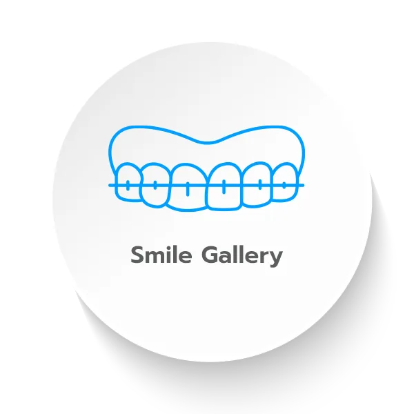 รีวิวทำฟัน Smile Gallery