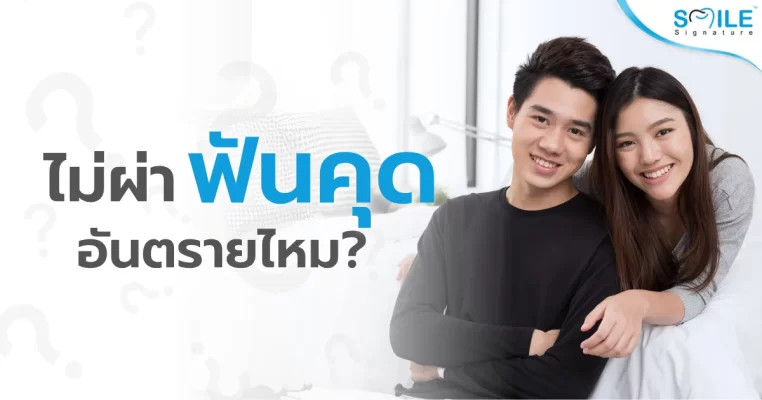 ฟันคุด