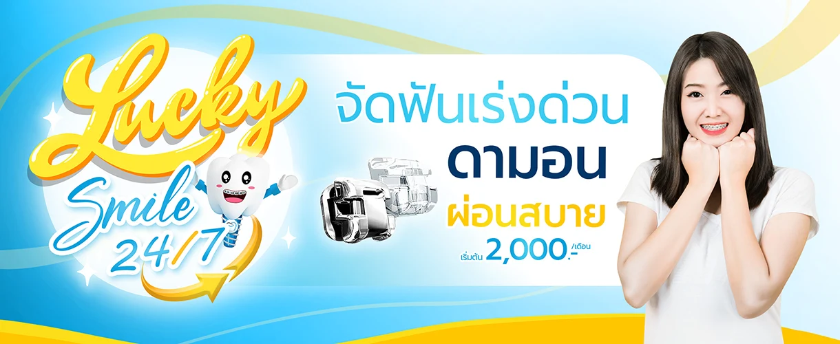 ราคาจัดฟันดามอน 2568