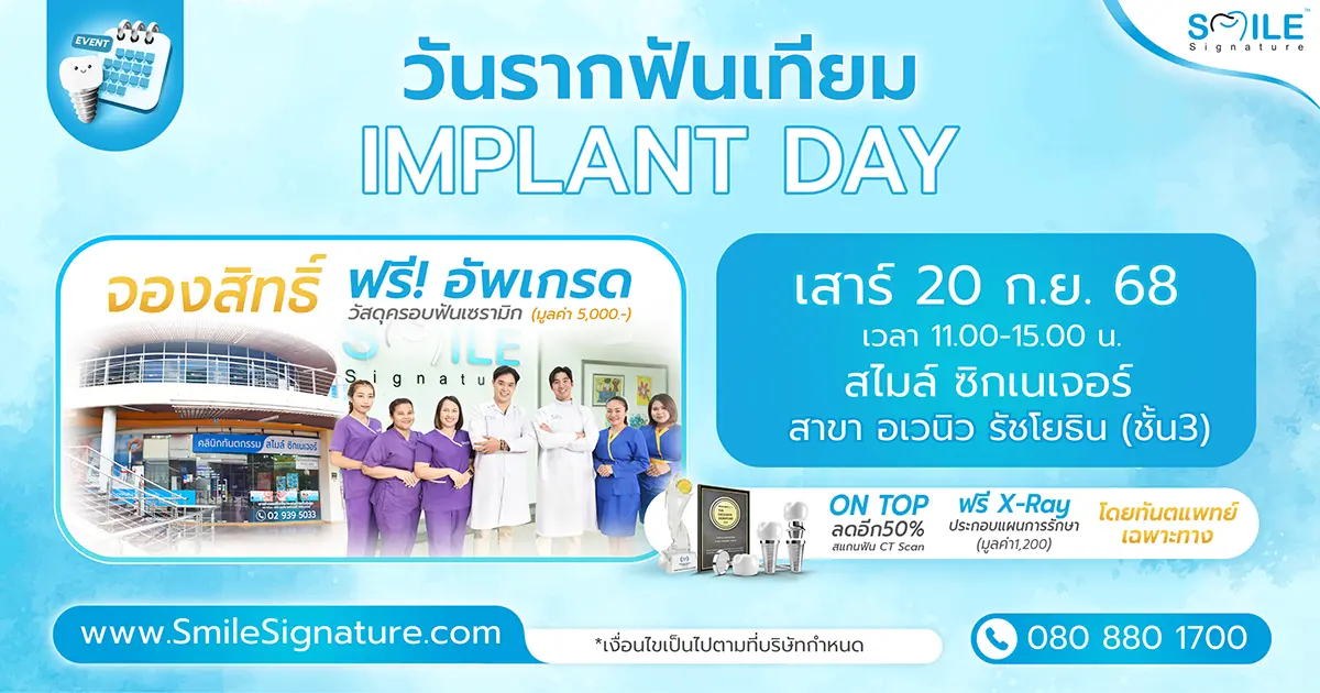 โปรโมชั่นรากเทียม อเวนิว รัชโยธิน