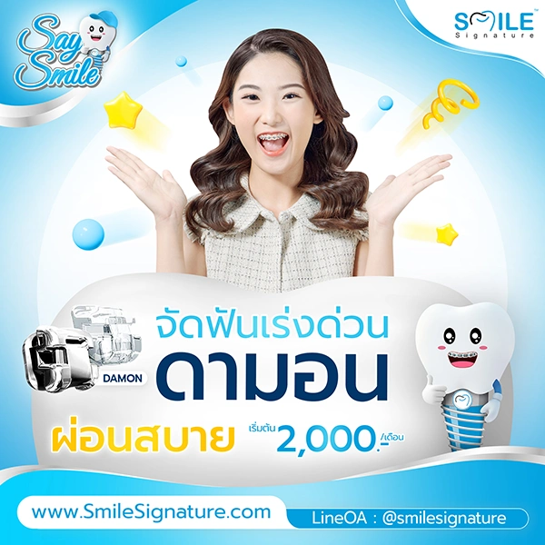 ราคาจัดฟัน 2568