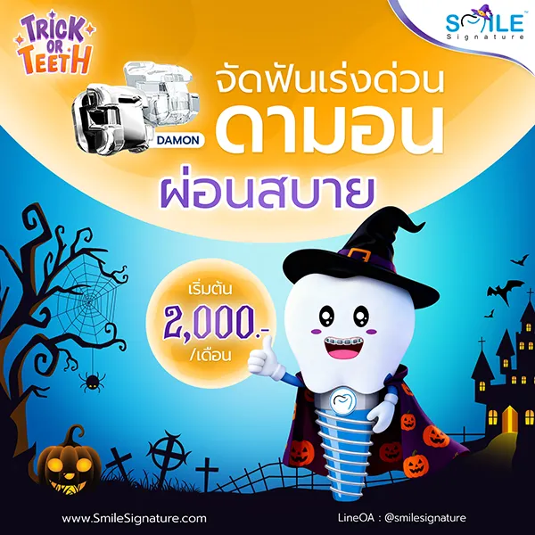 ราคาจัดฟัน 2568