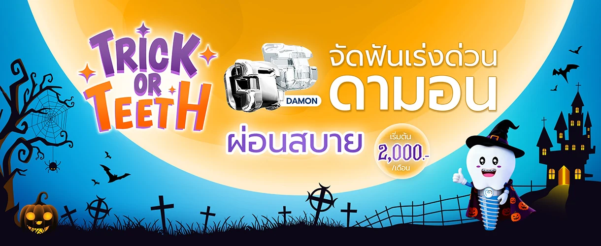 ราคาจัดฟันดามอน 2568