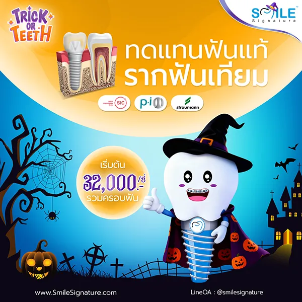 ราคา รากฟันเทียม