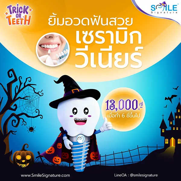 ทำวีเนียร์กี่บาท