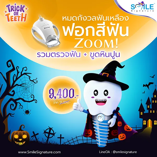 โปรฟอกฟันขาว ขูดหินปูน