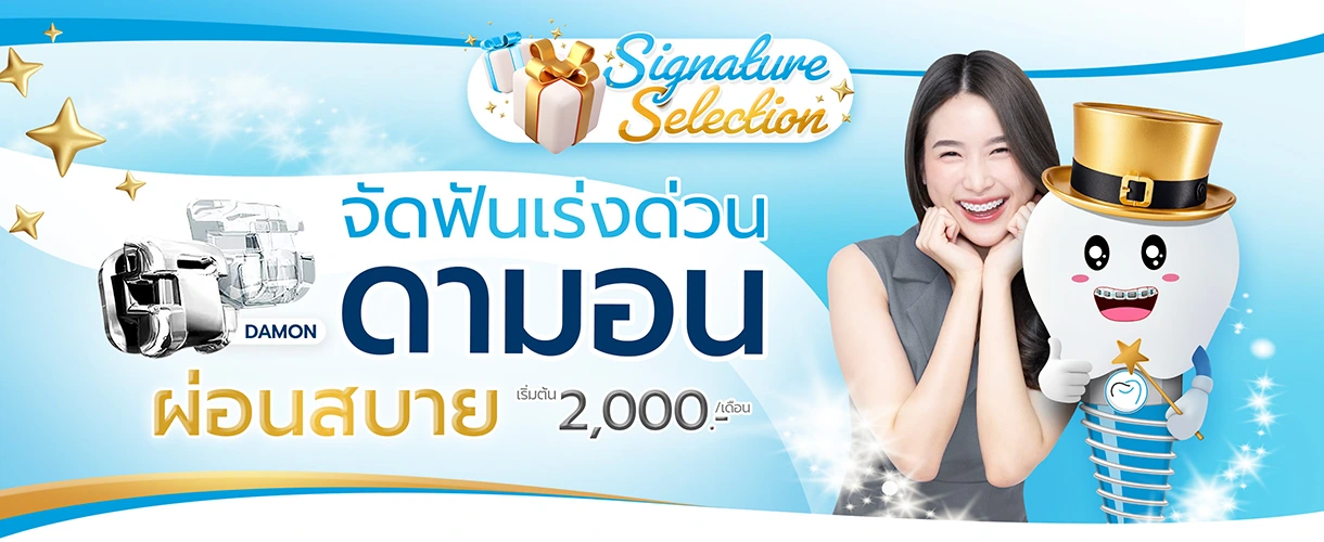 ราคาจัดฟันดามอน 2568