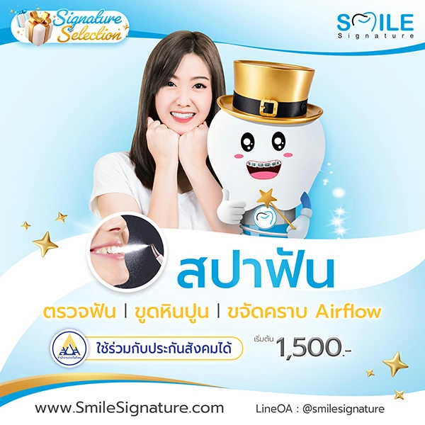 โปรโมชั่นทำฟันขาว SMILE SPA