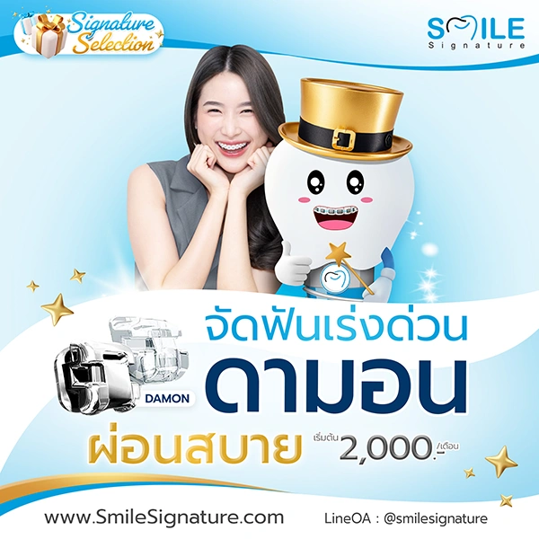 ราคาจัดฟัน 2568