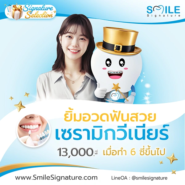 ทำวีเนียร์กี่บาท