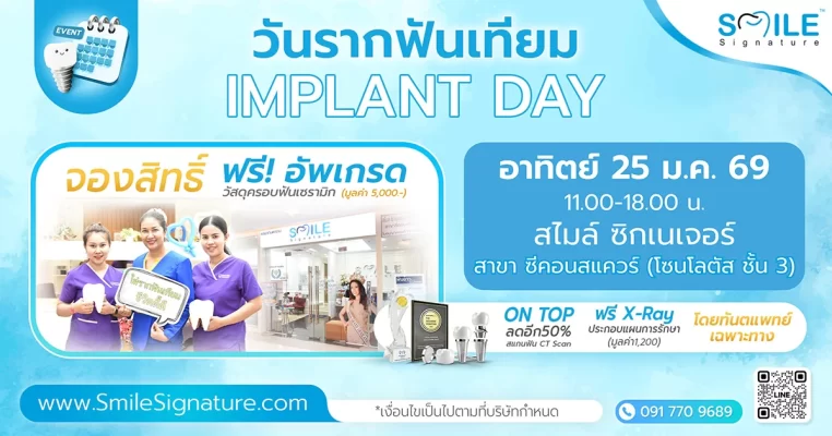 รากเทียม ซีคอนสแควร์