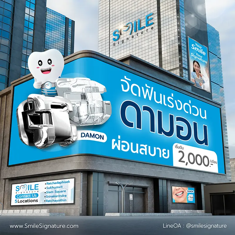 ราคาจัดฟัน 2569