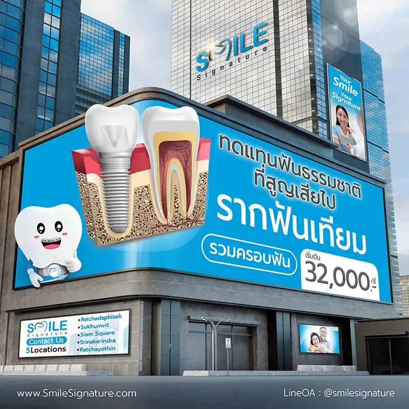 ราคา รากฟันเทียม