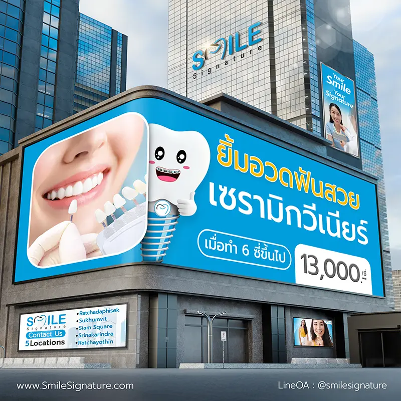 ทำวีเนียร์กี่บาท 2569