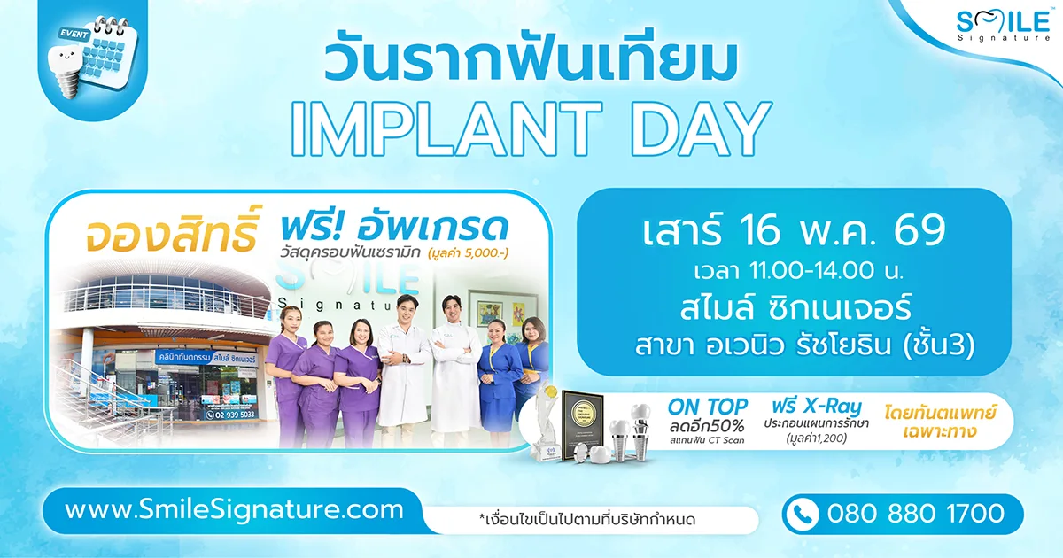 โปรโมชั่นรากเทียม รัชโยธิน