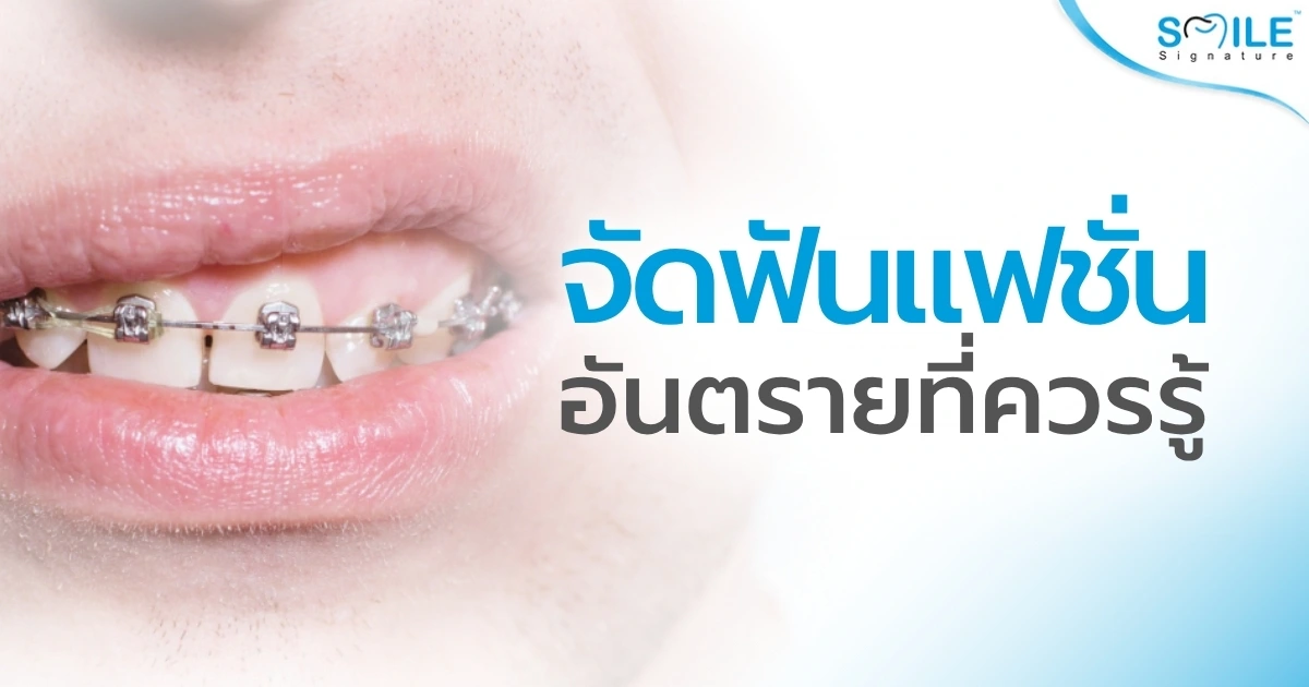 ผลเสีย ข้อเสีย จัดฟันแฟชั่น