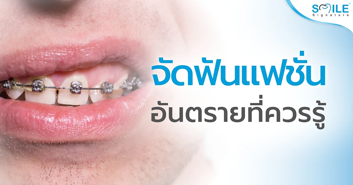 ผลเสีย ข้อเสีย จัดฟันแฟชั่น