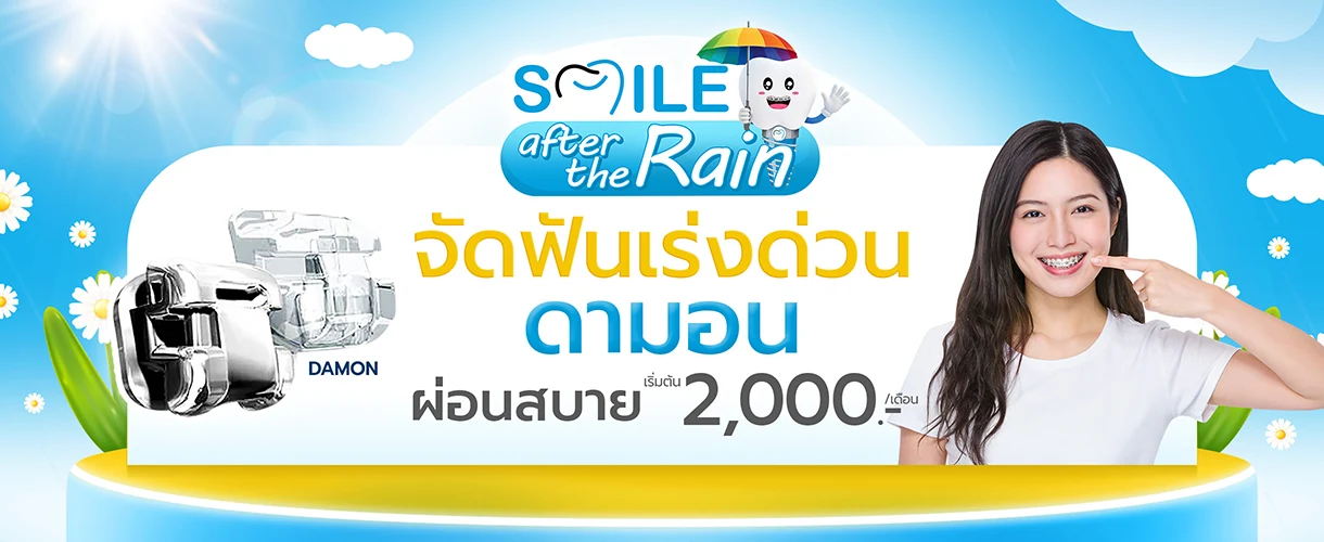 ราคาจัดฟันดามอน 2569