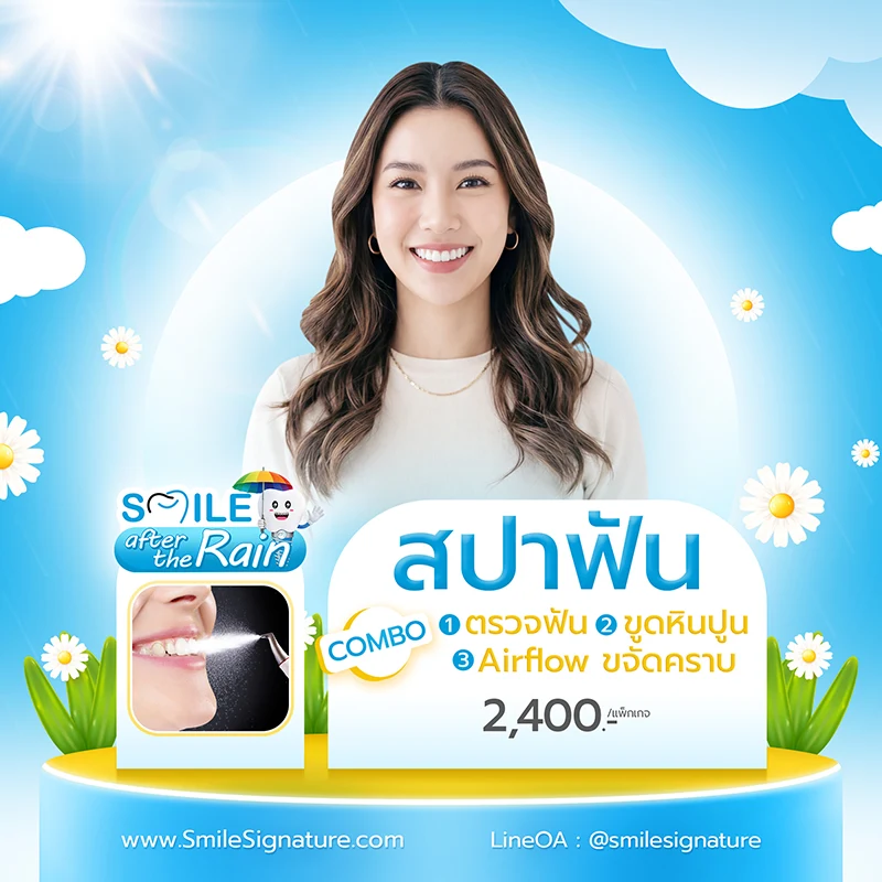 โปรโมชั่นทำฟันขาว SMILE SPA