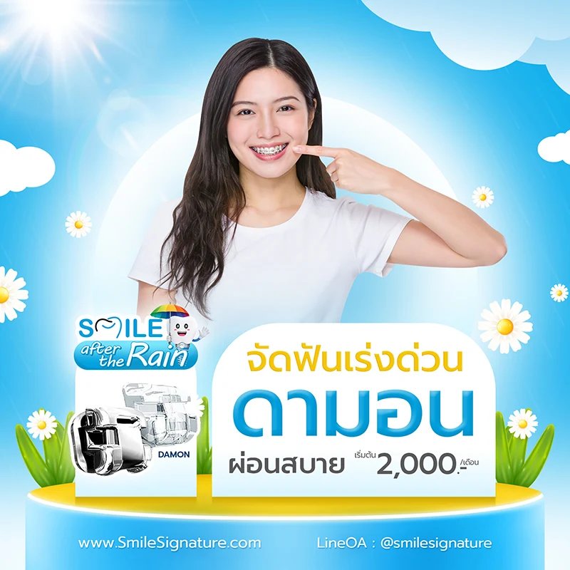 ราคาจัดฟัน 2569