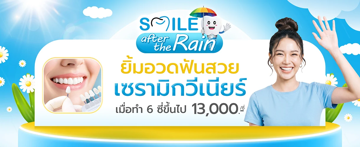 ทำวีเนียร์กี่บาท