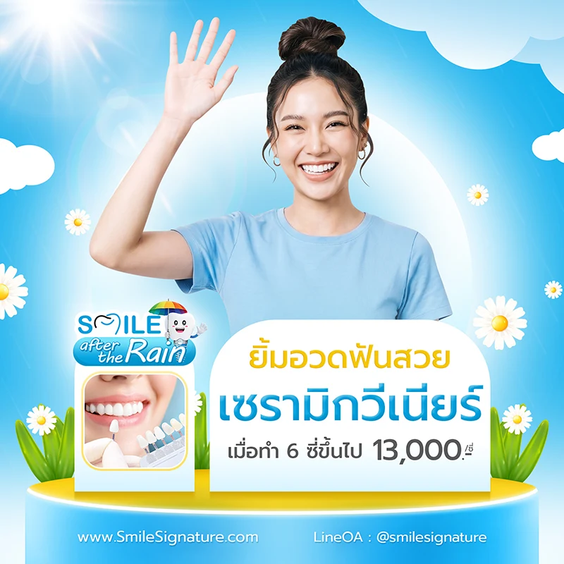 ทำวีเนียร์กี่บาท 2569