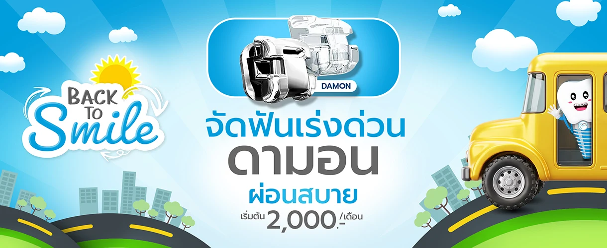 ราคาจัดฟันดามอน 2569